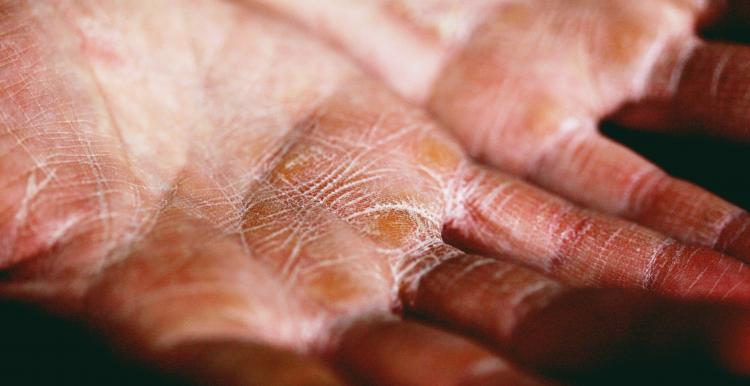 Close up of dry hands