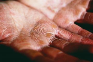 Close up of dry hands