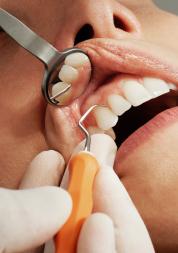 Close-up of a woman's teeth being examined by a dentist